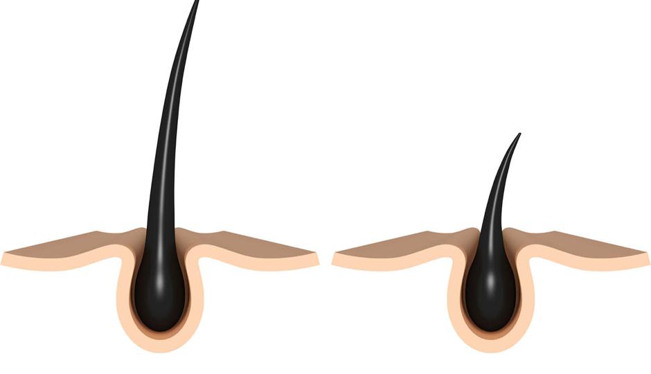 Anagen Phase of Hair Growth