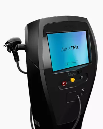 alma ted non surgical treatment 1 alma ted non surgical treatment 1
